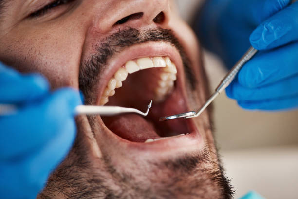 Best Walk-In Emergency Dental Services in Zachary, LA
